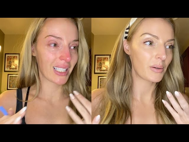 How To Get Rid Of Puffy Eyes From Crying: Quick Fixes