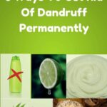 How Do I Get Rid Of Dandruff Permanently