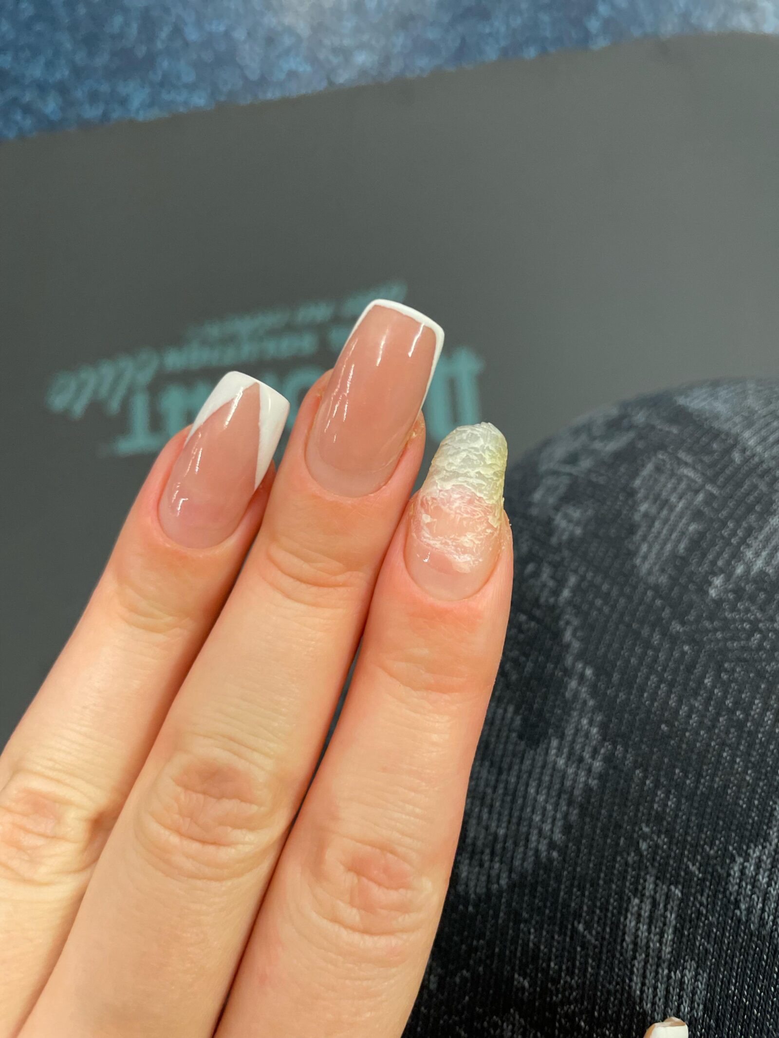 How Fast Does Kerasal Make Nail Fall Off