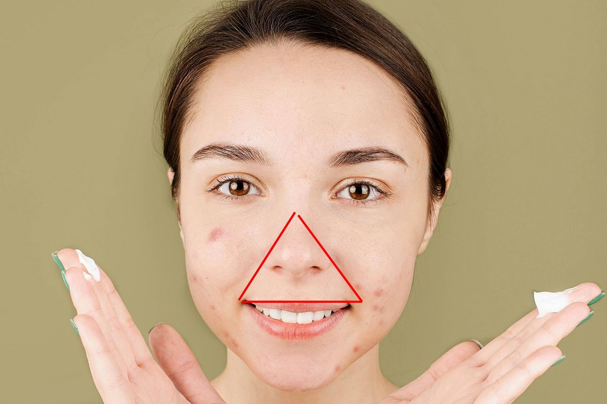 I Popped A Pimple In The Triangle Of Death: Risks Revealed!