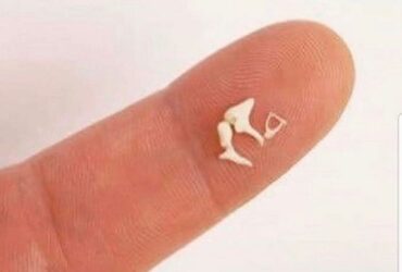 Which Is The Smallest Bone Of Human Body